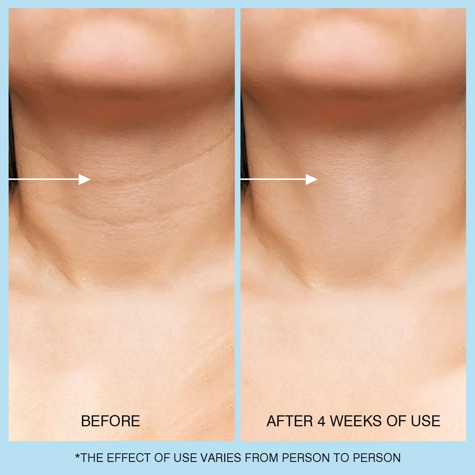 UJhay 3-in-1 Neck-Face-Chest application demonstrates versatile routine.