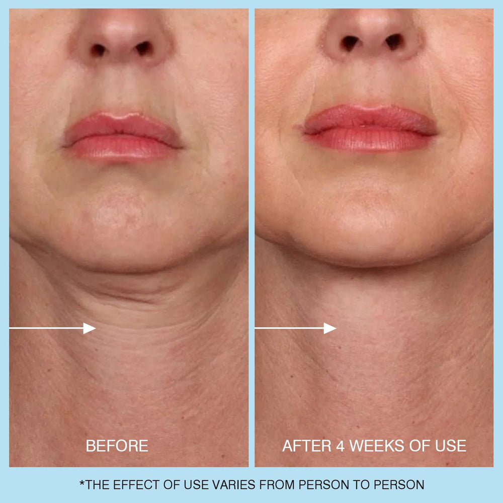 UJhay Neck Cream packaging highlighting lightweight, non-greasy finish.