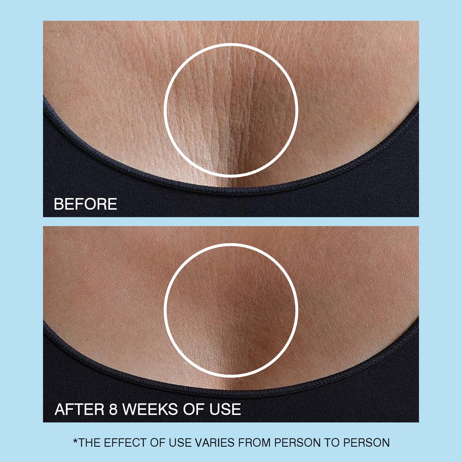 UJhay Neck Cream suited for all skin types and daily hydration.