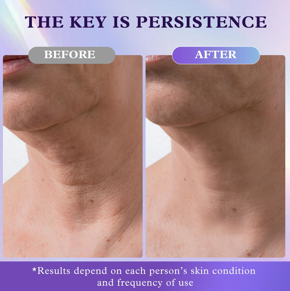 UKVOA skin-types-friendly cream texture ready for absorption