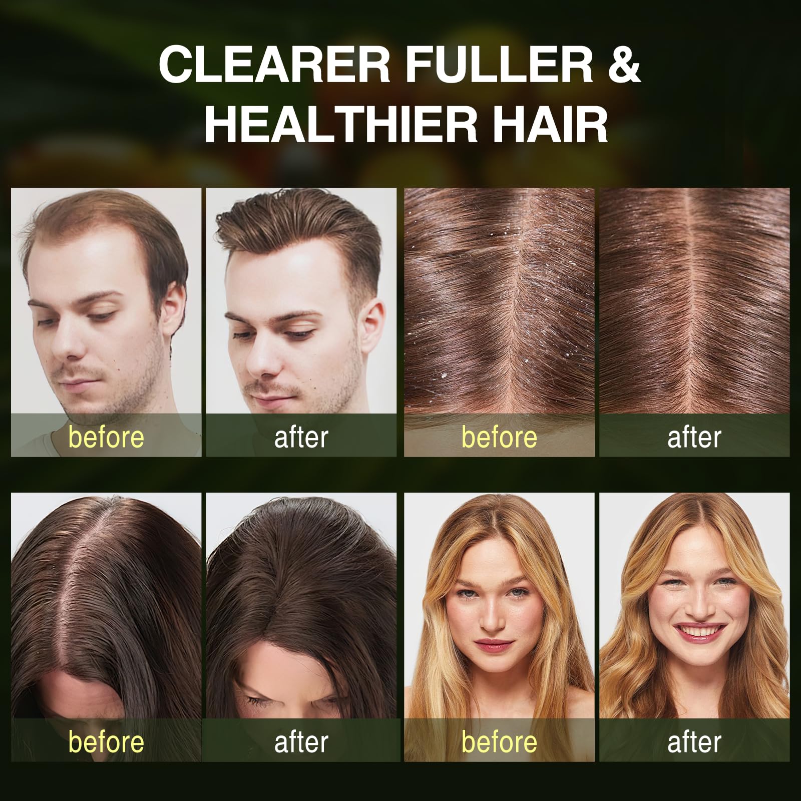 ulluxe Sulfate-Free Formula signals gentle cleansing for sensitive scalps.