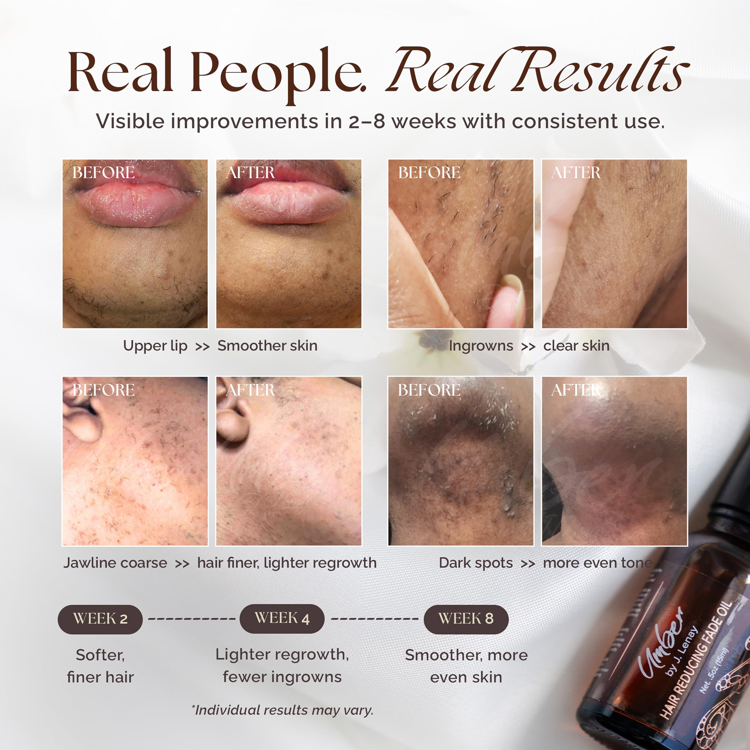 Umber By J. Lenay hair reduction spot fade oil demonstrates targeted treatment for problem areas