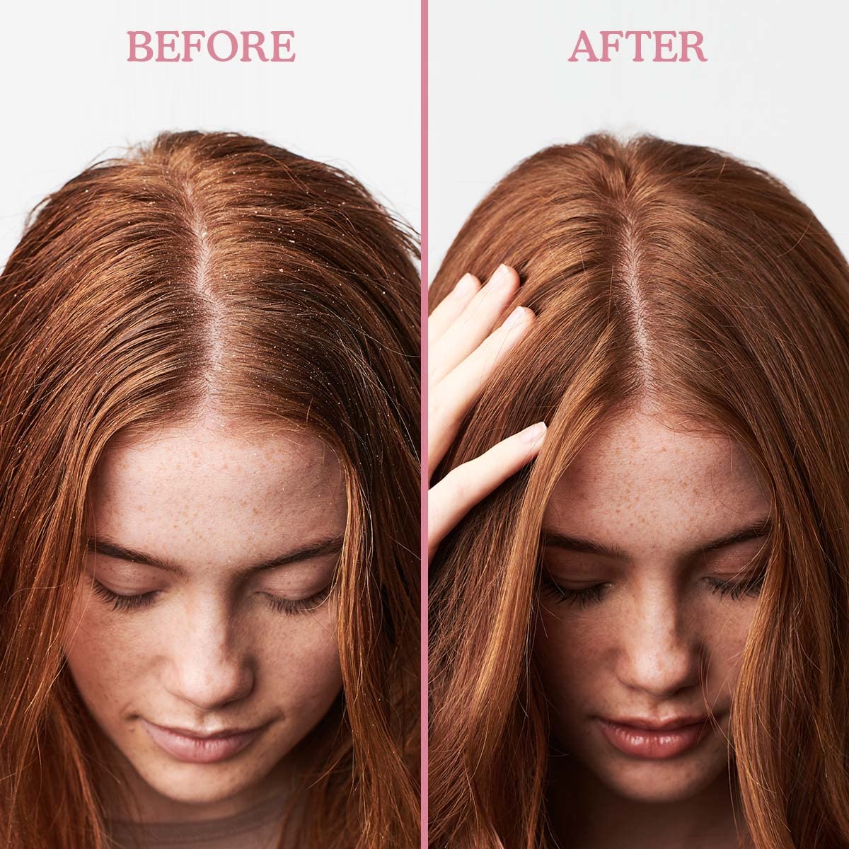 Umberto Giannini Scalp Restore close-up bottle for gentle cleansing.