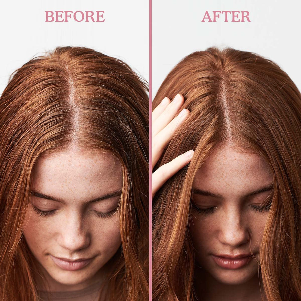 Umberto Giannini Scalp Restore close-up bottle for gentle cleansing.
