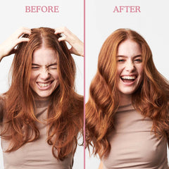 Umberto Giannini Scalp Restore pineapple enzyme label showing exfoliation.