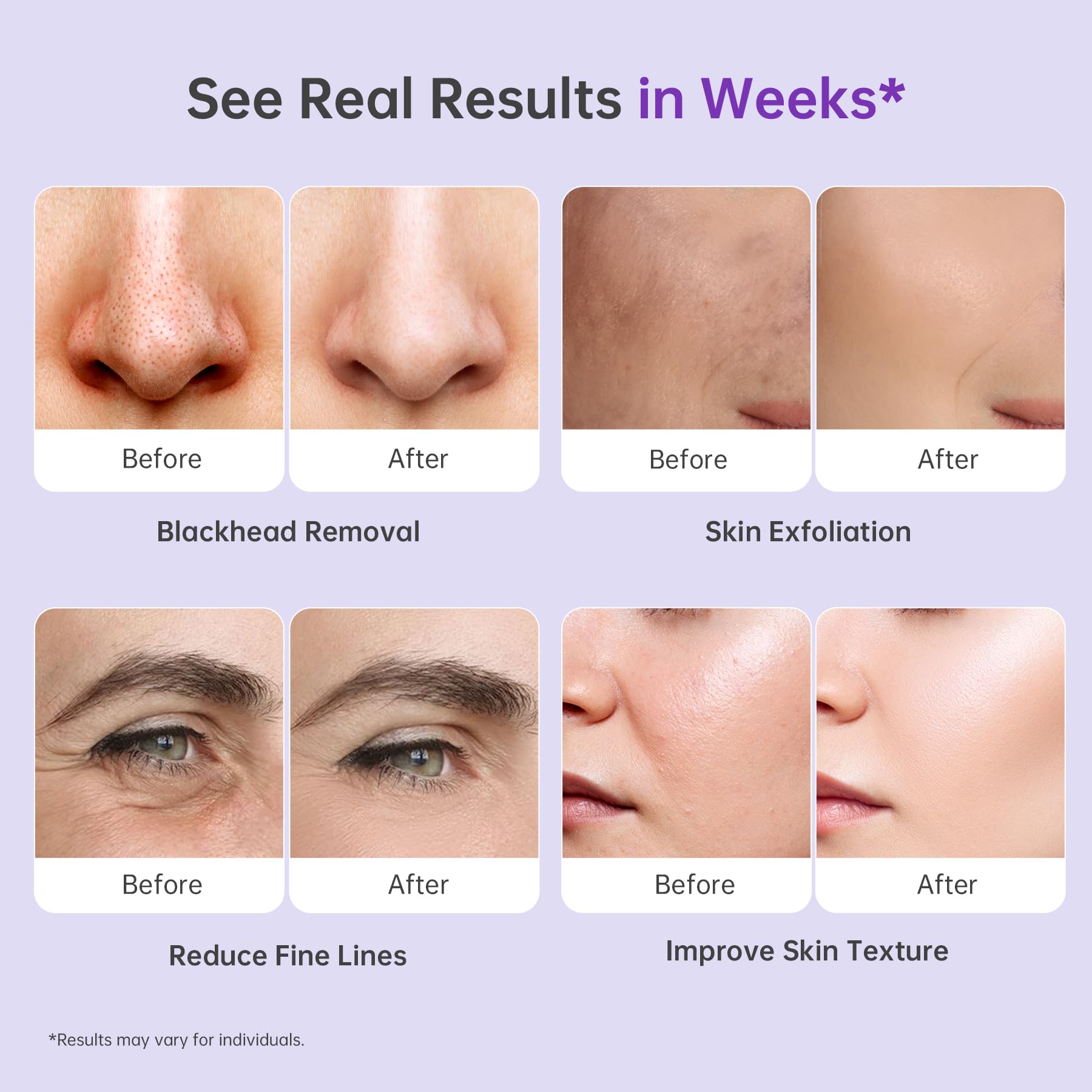 UNOISETION all-skin-types compatibility with adjustable suction shown.