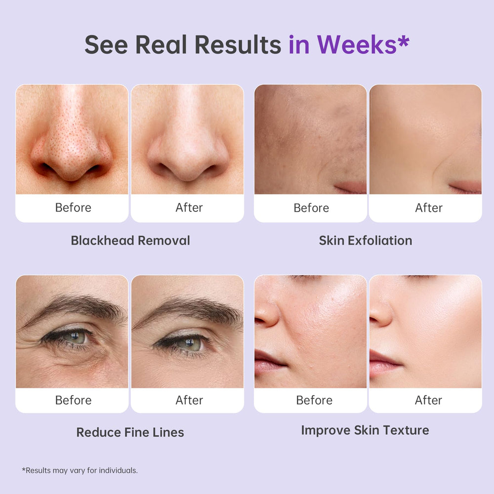 UNOISETION all-skin-types compatibility with adjustable suction shown.