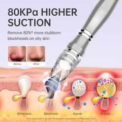 UNOISETION diamond-tip exfoliation detail illustrating gentle dead skin removal.