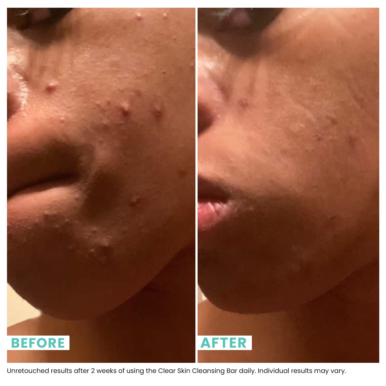 Urban Skin Rx Clear Skin bar helps refine uneven tone with ClearTone technology