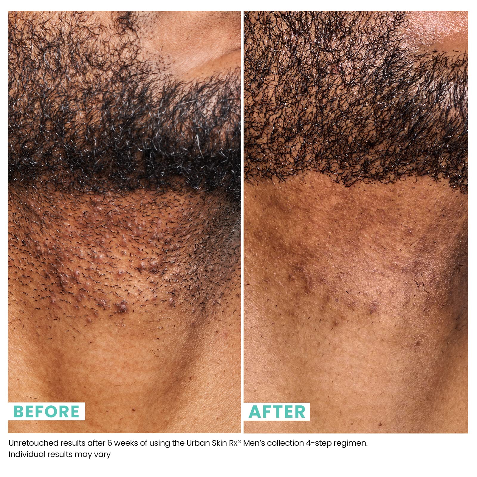 Urban Skin Rx Men’s packaging showing the two-in-one cleanser and scrub for daily use.