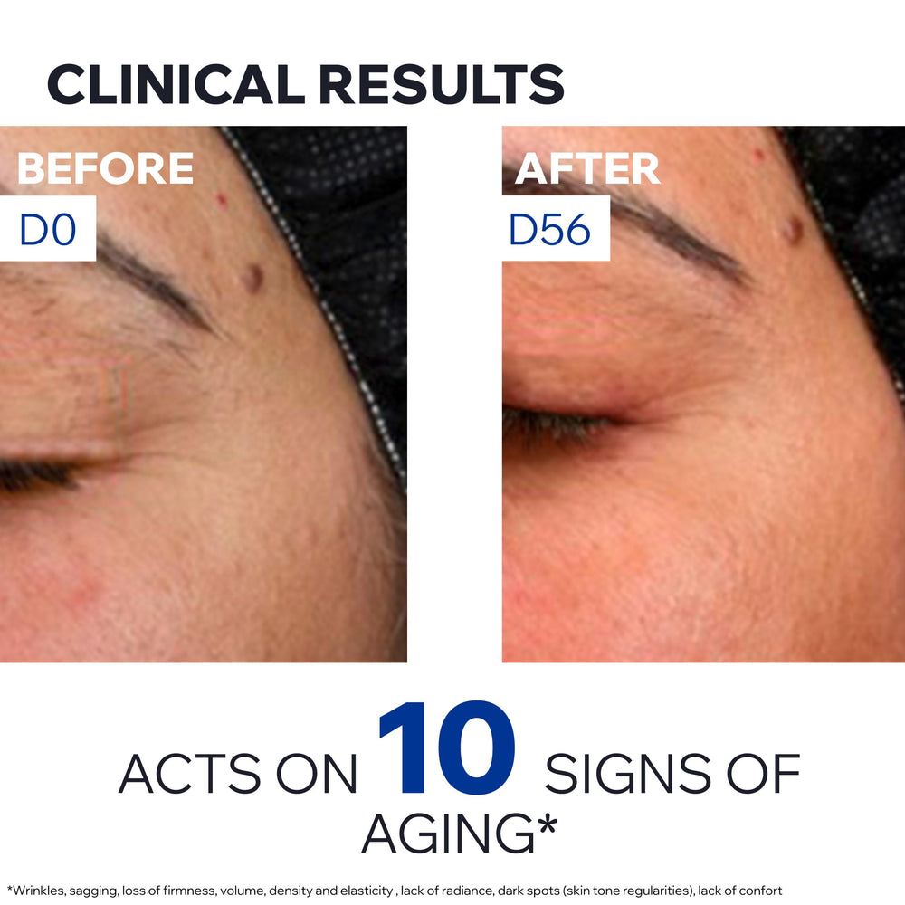 Uriage Age Absolu formula suitable for mature and sensitive skin