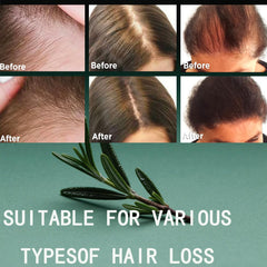 Urnuos Rosemary Biotin Shampoo pump-dispense showing easy daily use for thinning hair