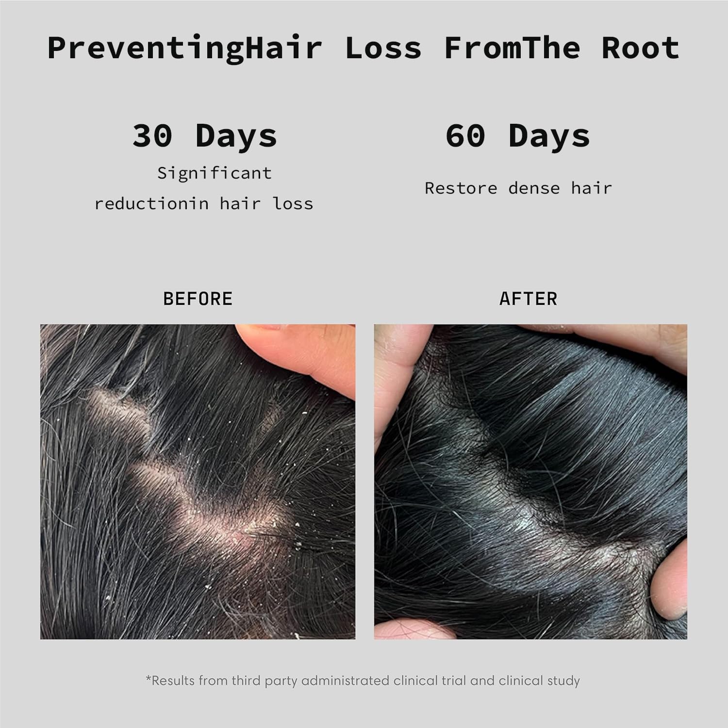 Urnuos Rosemary rosemary leaves highlight organic extract