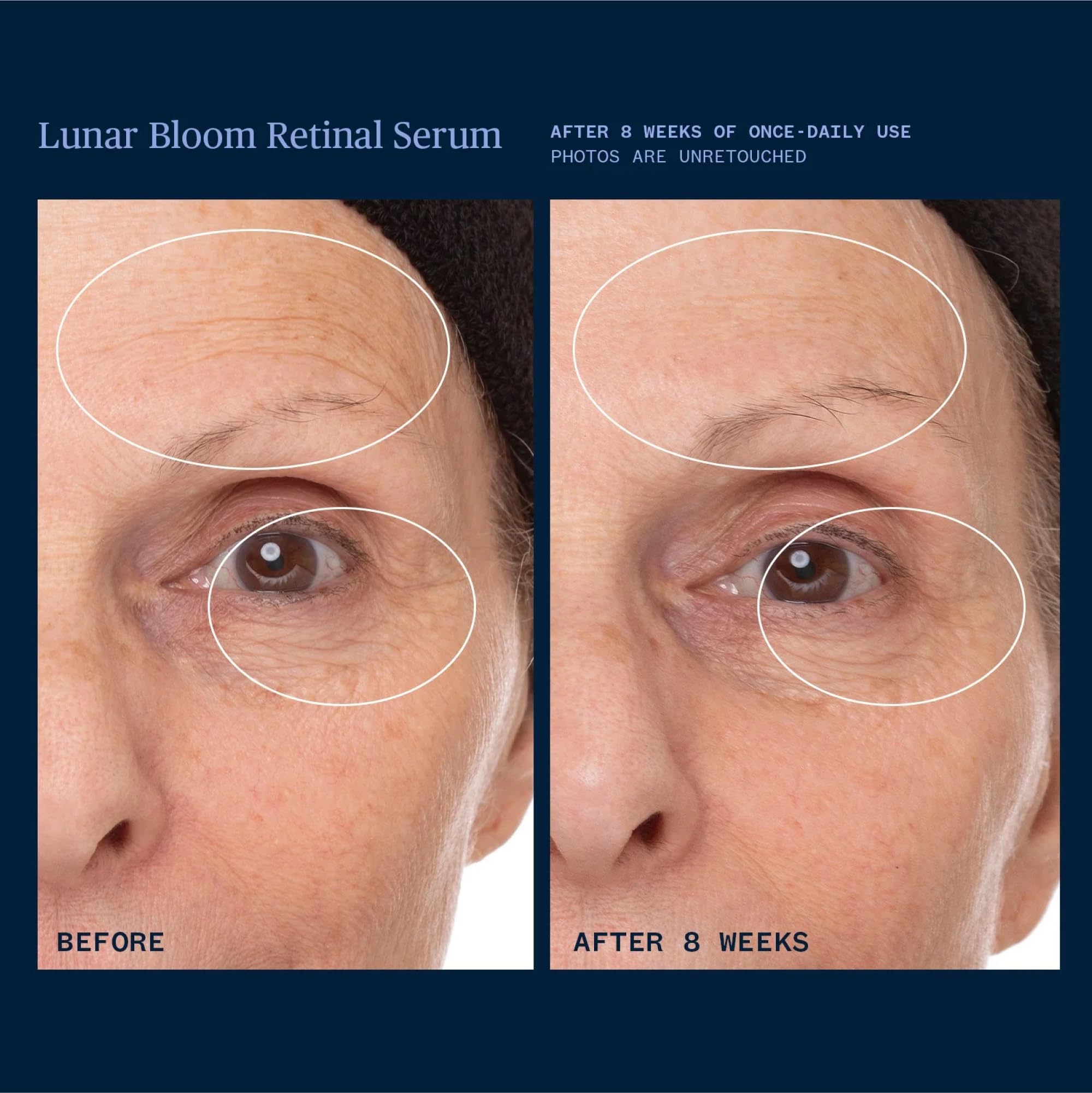Ursa Major Lunar Bloom Serum packaging and label.
