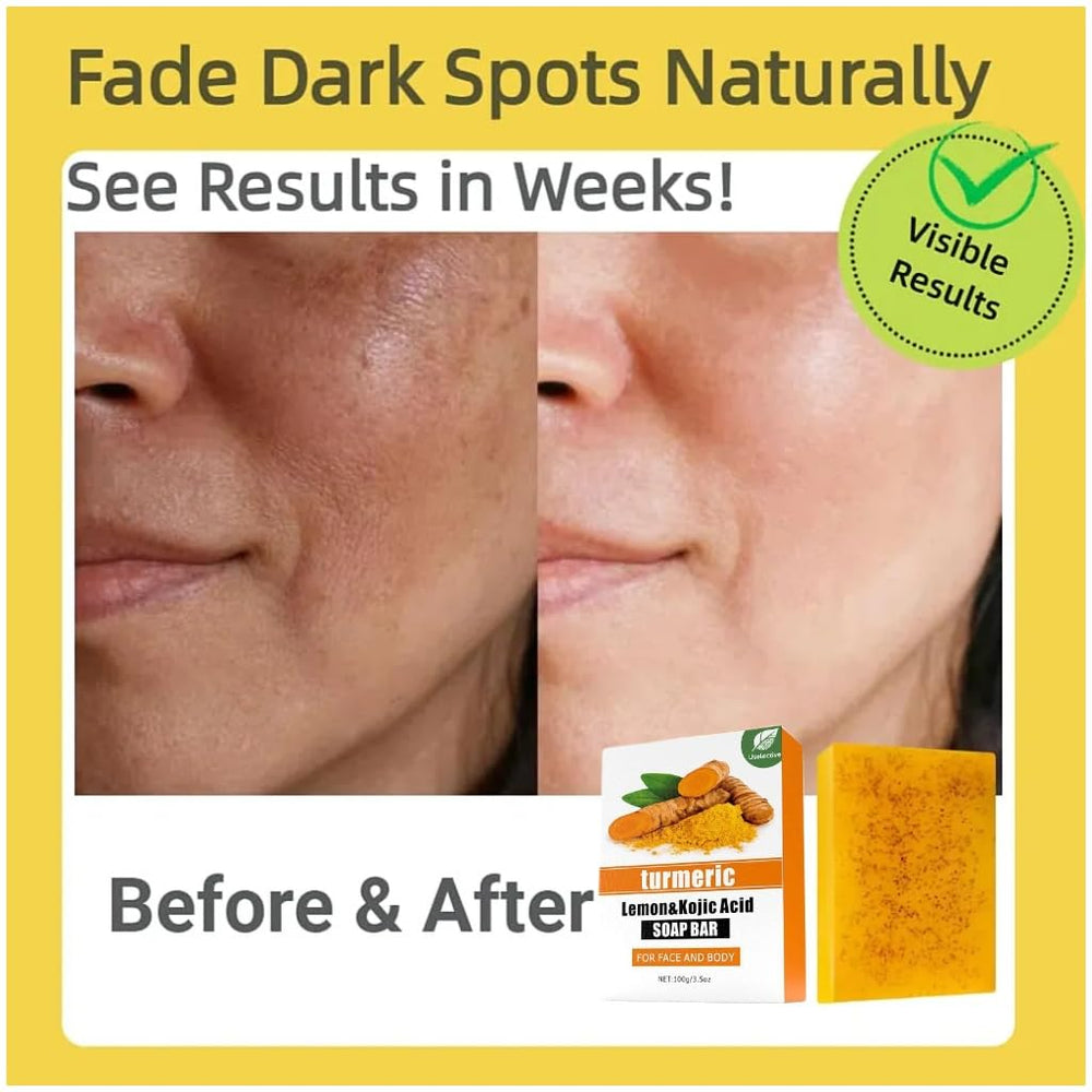 Uselective turmeric-lemon glow soap bar vitamin C highlight for radiant look