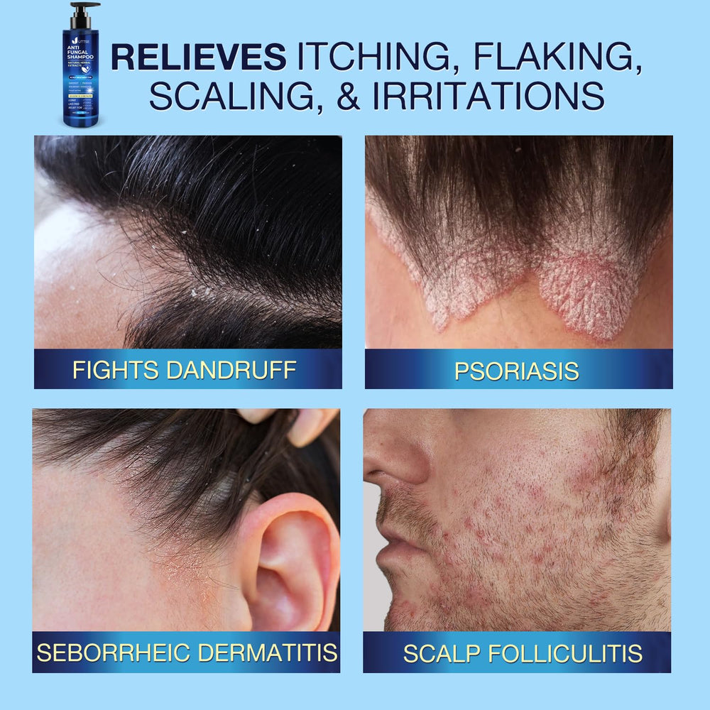 Uttse shampoo scalp massage scene illustrating soothing application.