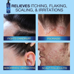 Uttse shampoo scalp massage scene illustrating soothing application.