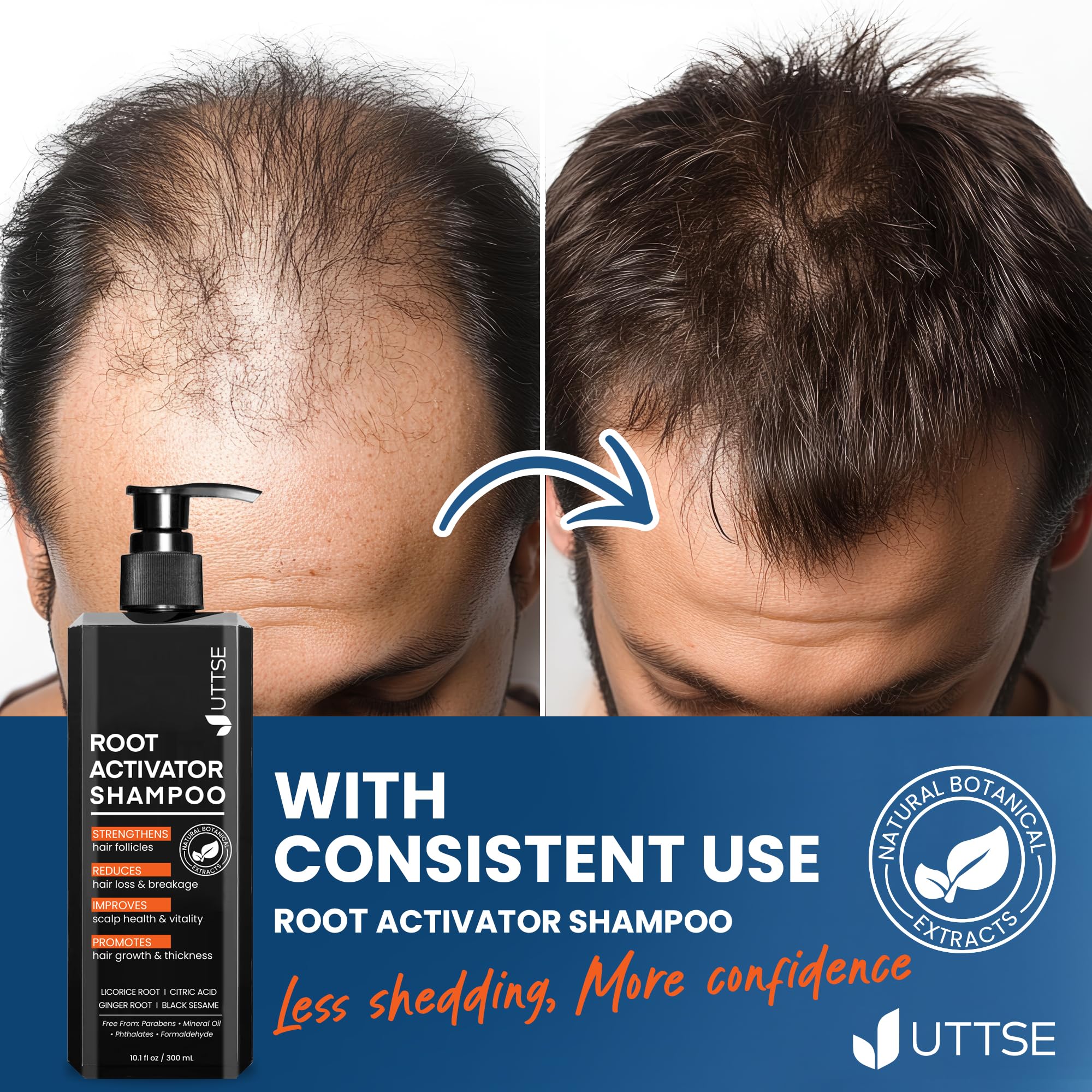 Product-in-use shot with lather around the hairline.
