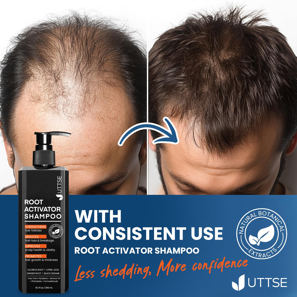 Product-in-use shot with lather around the hairline.