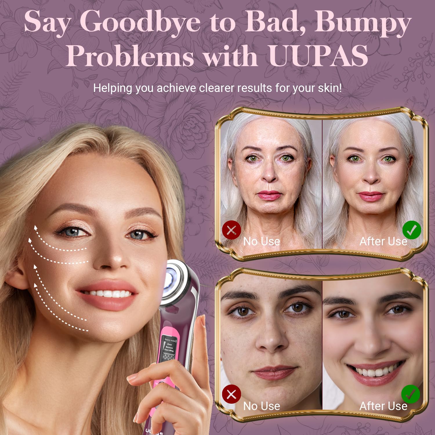 UUPAS adjustable intensity control enables personalized skincare sessions