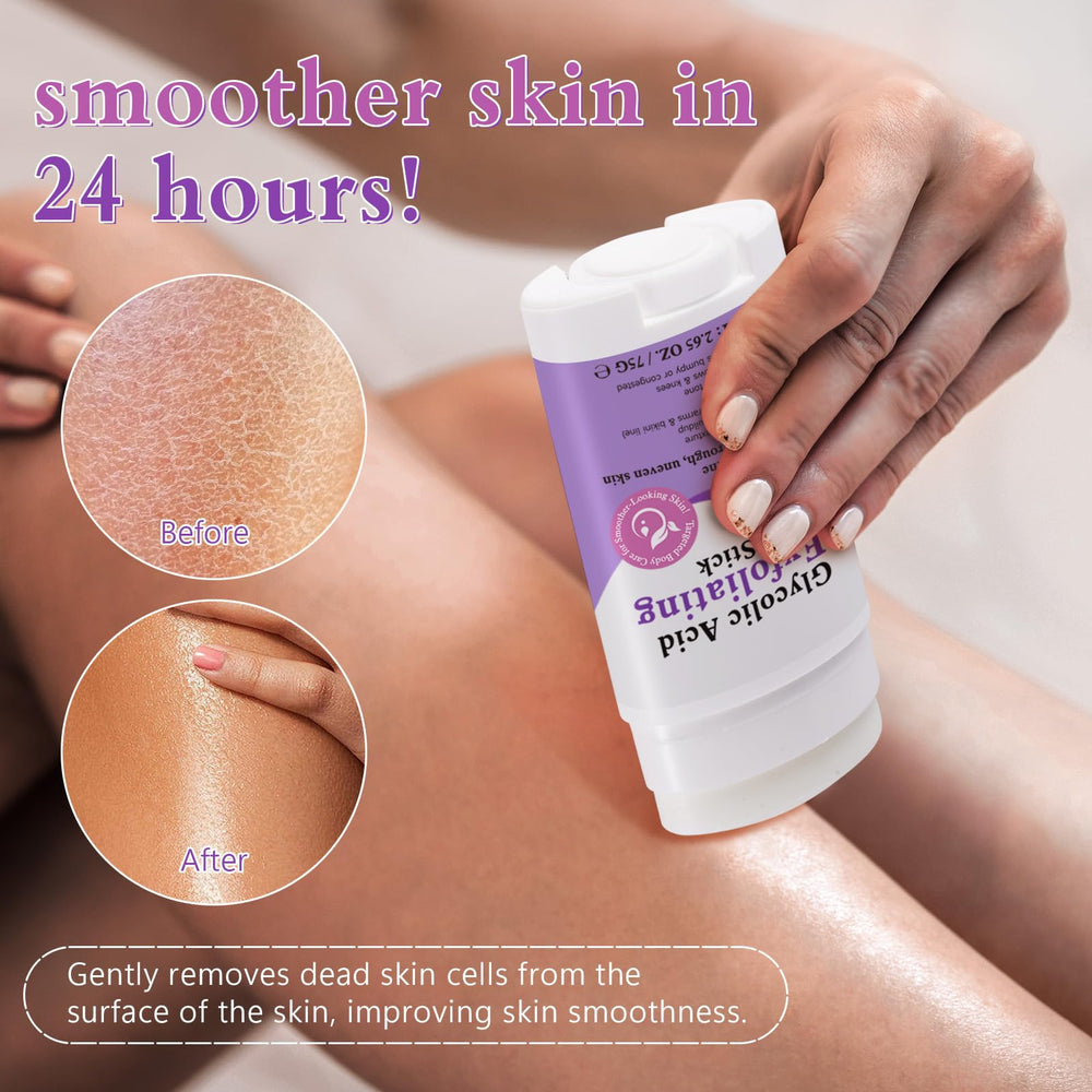 UXENPHXF Glycolic Exfoliating Body Stick for dry-area use targets rough patches on arms and legs.