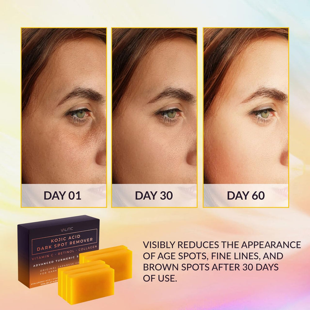 VALITIC soap pack with five bars ready for daily use and value