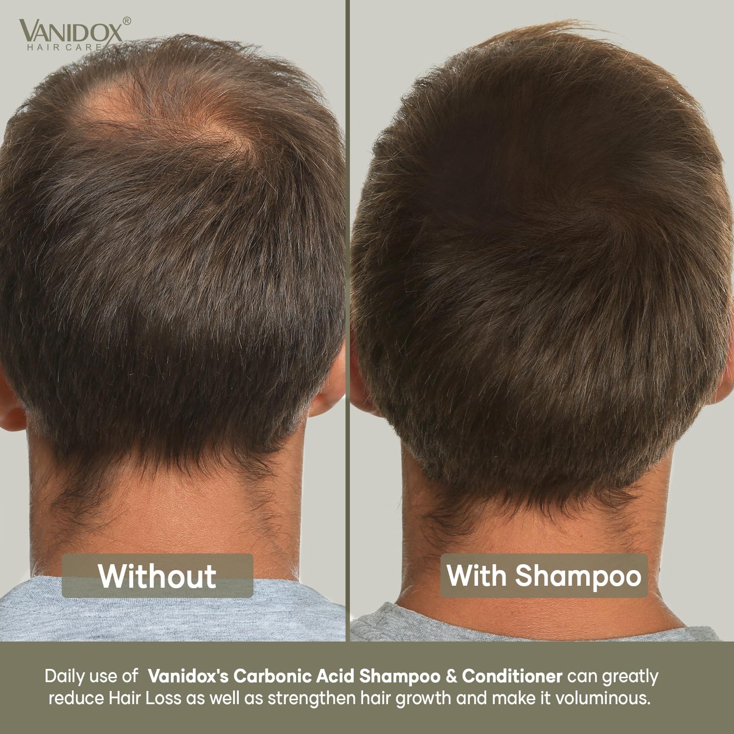 Vanidox cruelty-free emblem reinforces ethical, sulfate-free formulation.