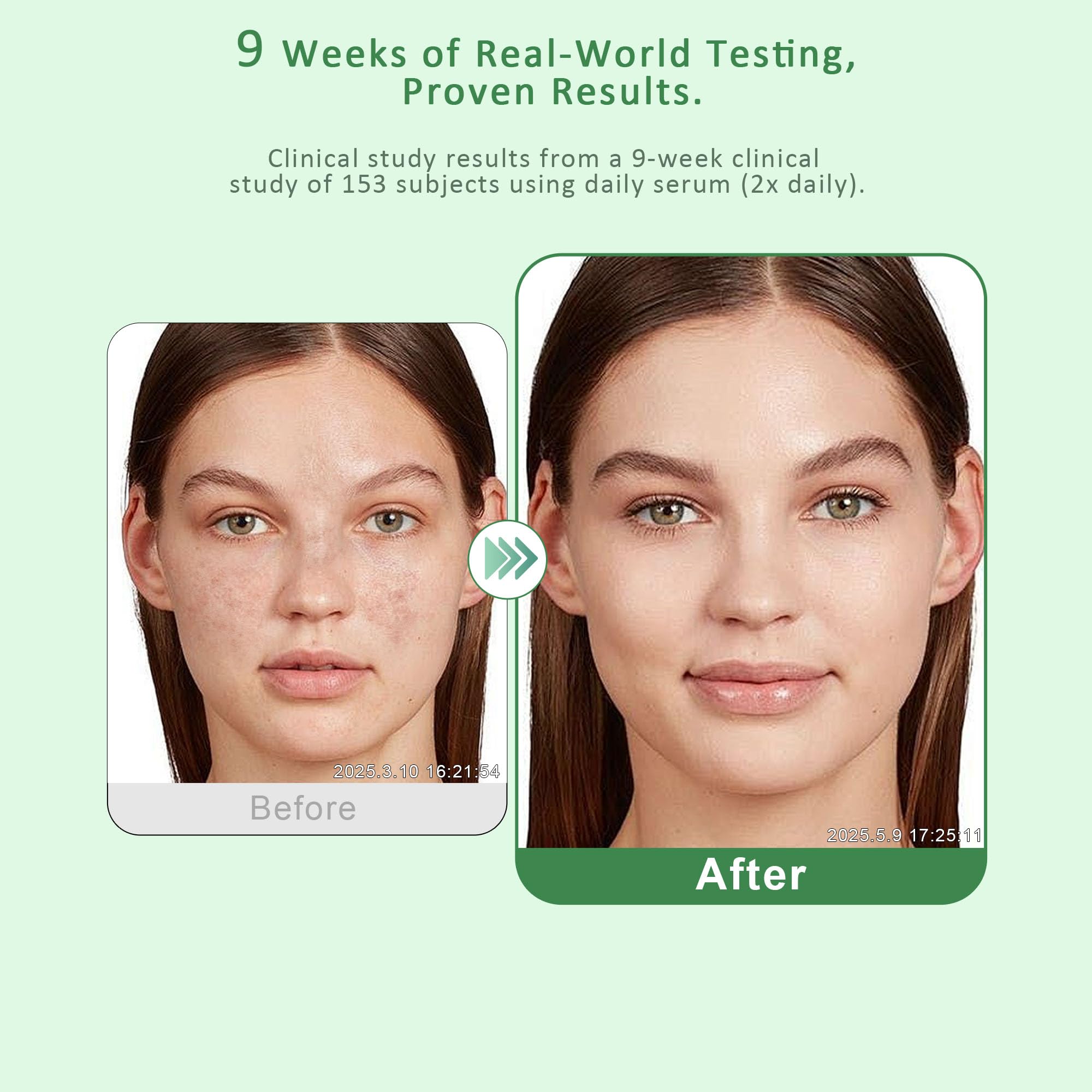 VBBV hand-application of serum on skin for body use