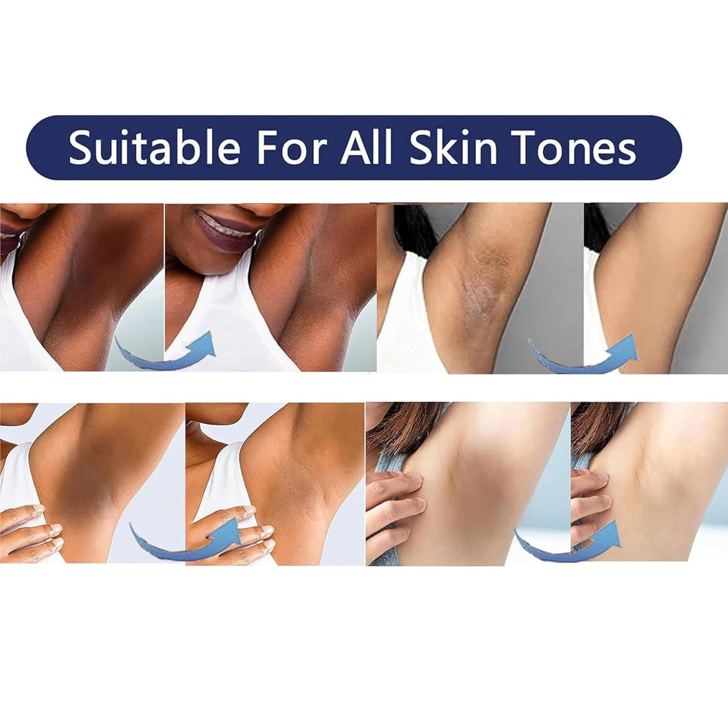 VCETREE inner thigh bikini area cream delivering subtle radiance