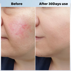 Vcycal two-type beauty light options for targeted skincare sessions