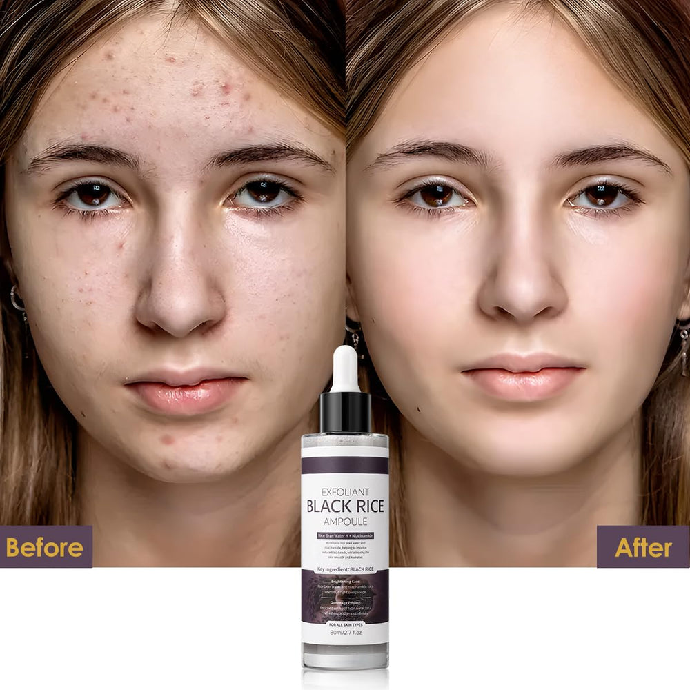 Veakoo Peel Shot Glow ingredient blend with botanicals for antioxidant support