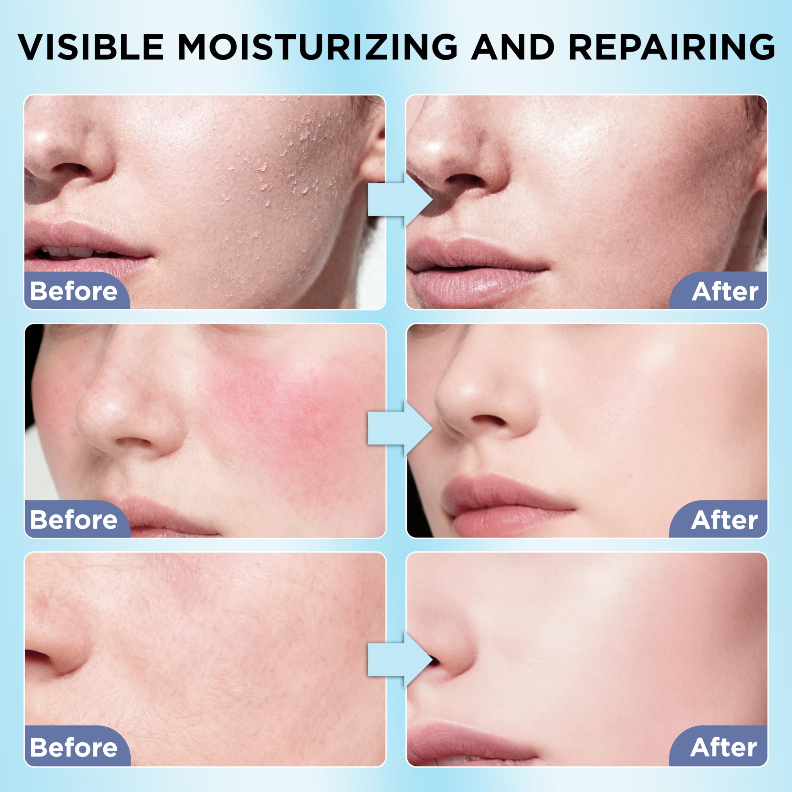 Veakoo skin moisture application on hands for non-greasy hydration.