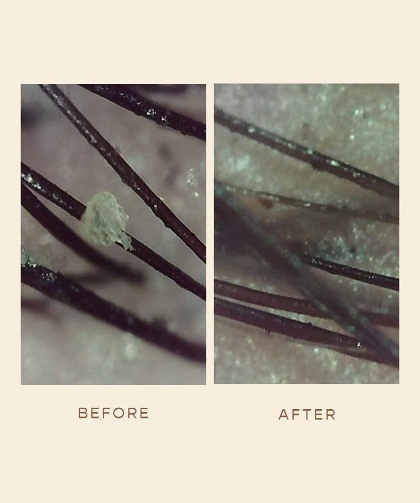 Parting hair to detox scalp for 5-10 minutes