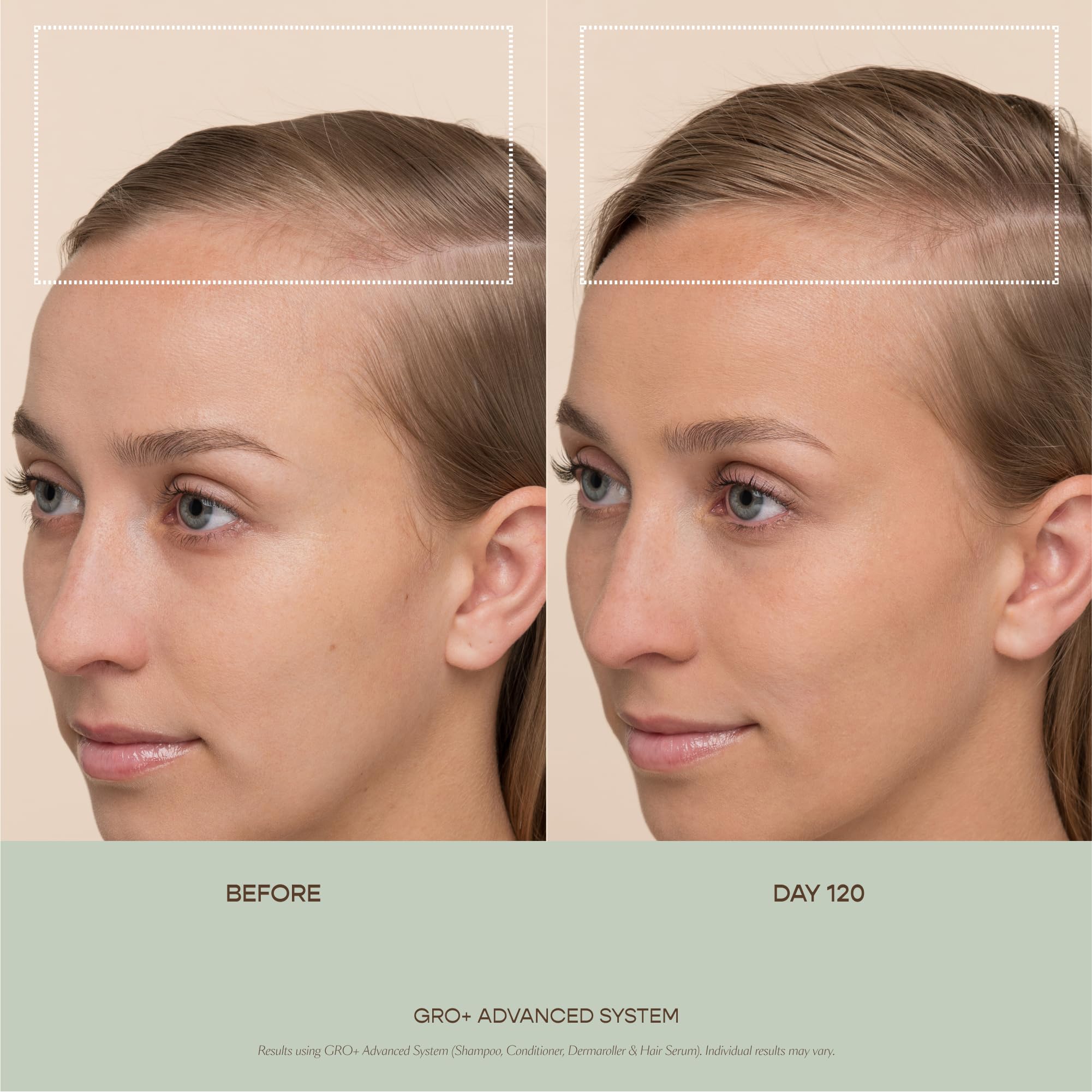 In-use scene with GRO+ for daily scalp care