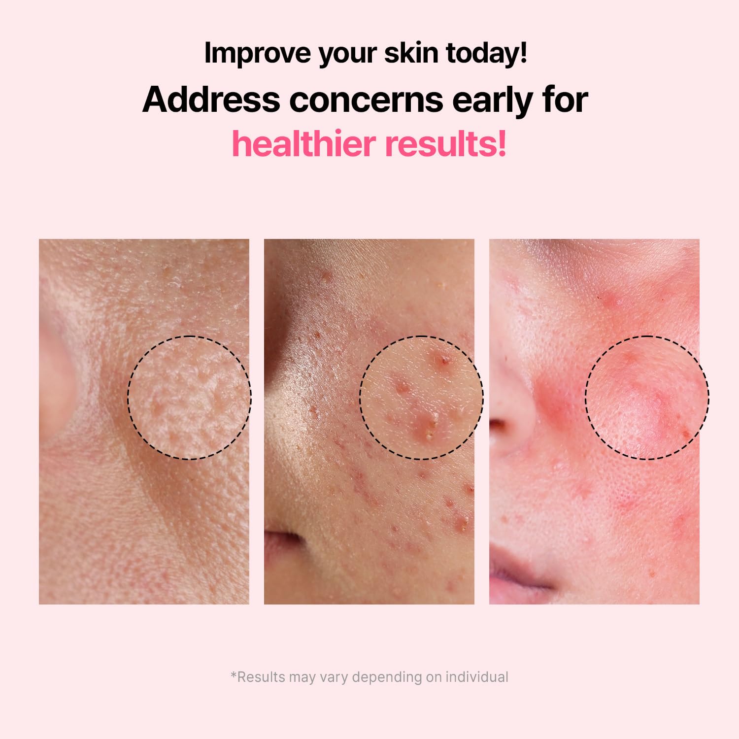 VEGANIFECT Pore Refining Ampoule dropper detail for targeted care