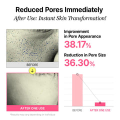 VEGANIFECT Pore Refining Ampoule with fig extract for oil balance