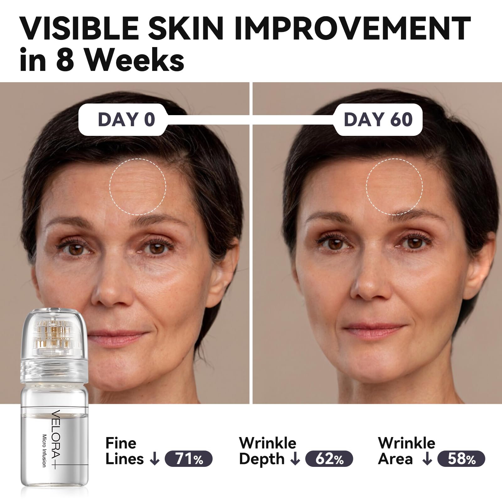 VELORA at-home facial kit enables effortless care with a compact, all-in-one system