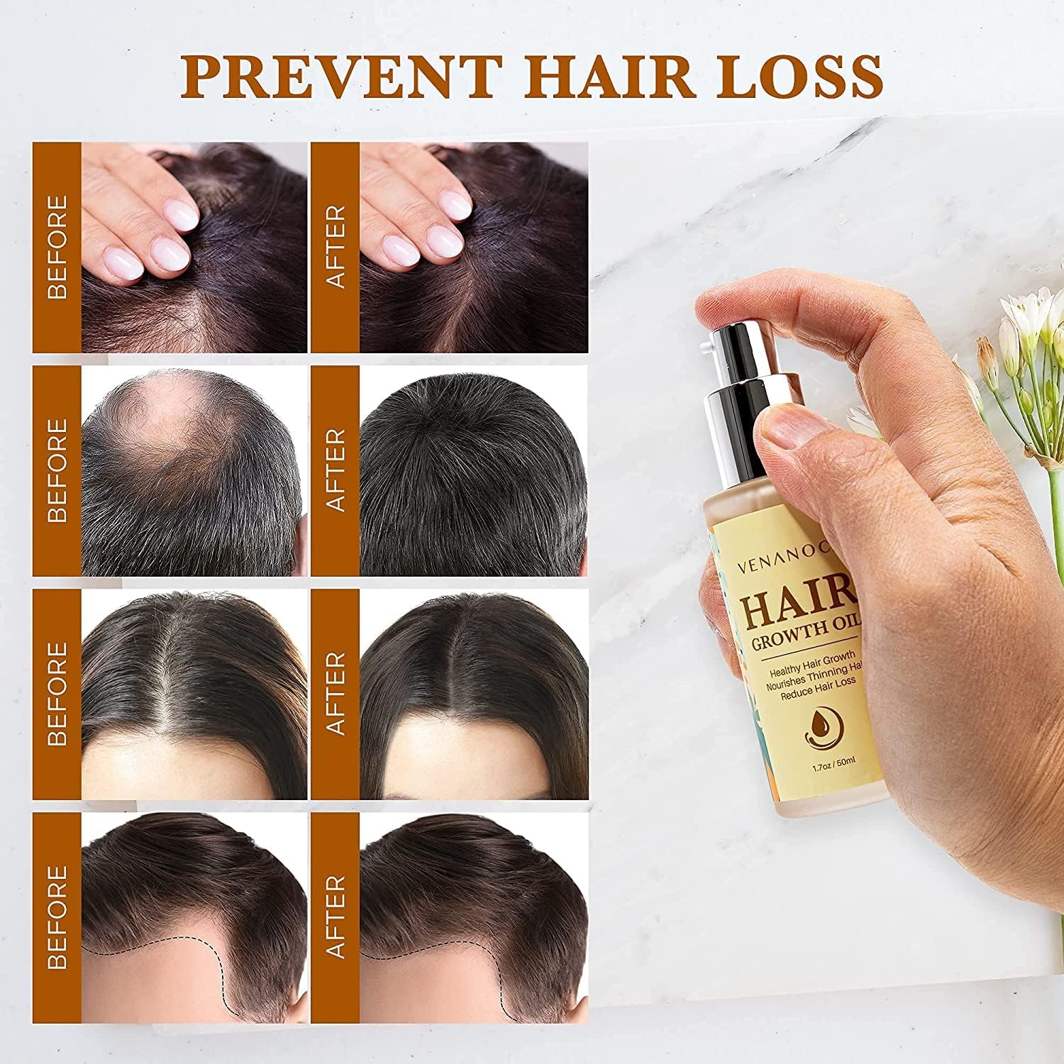 Venanoci hair growth serum application demonstrates root-to-tip massage for stronger strands