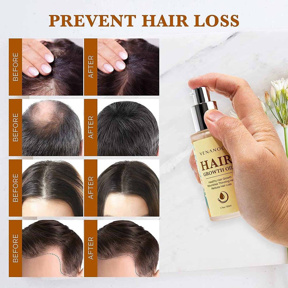 Venanoci hair growth serum application demonstrates root-to-tip massage for stronger strands