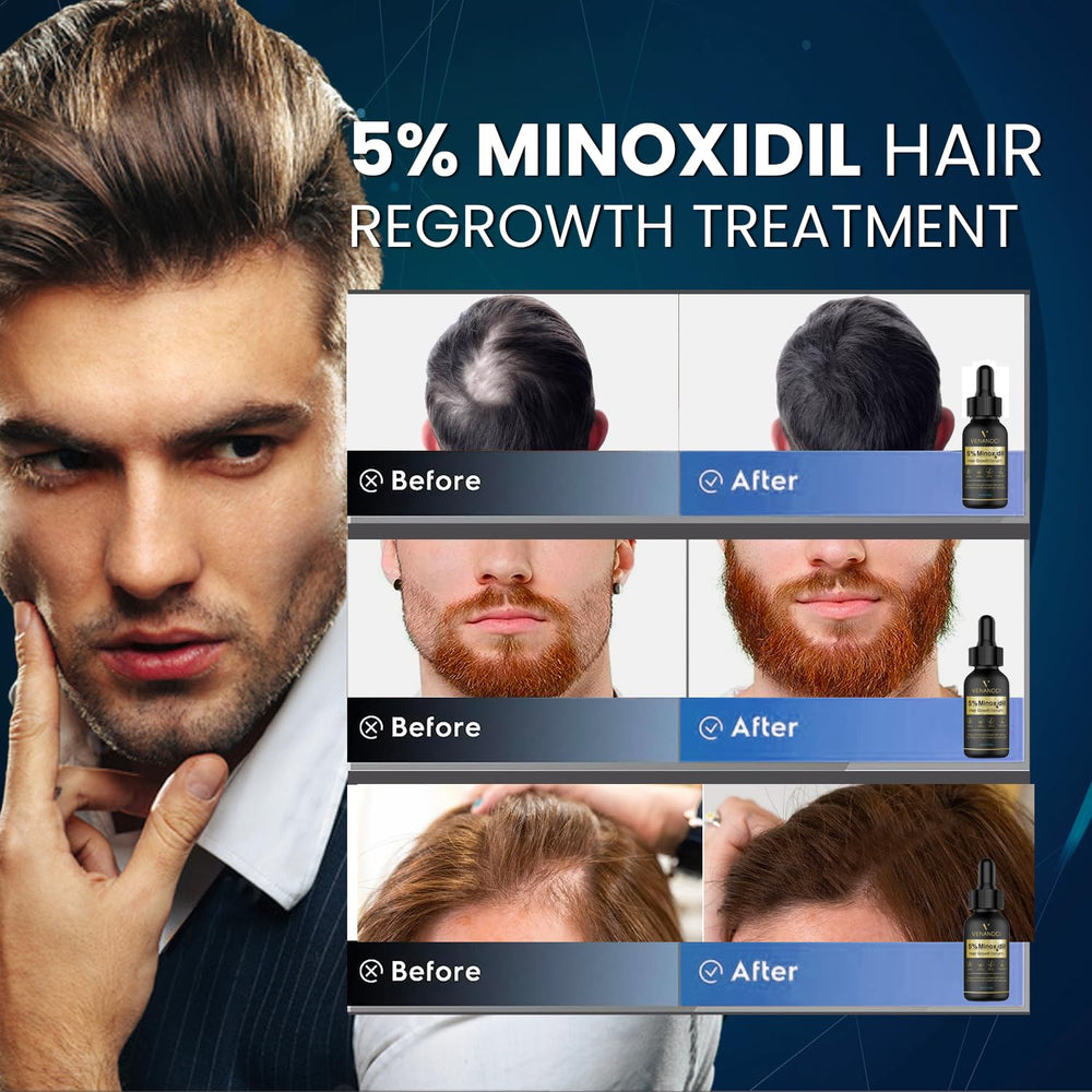 Dropper applying Venanoci serum to scalp for targeted follicle nourishment.
