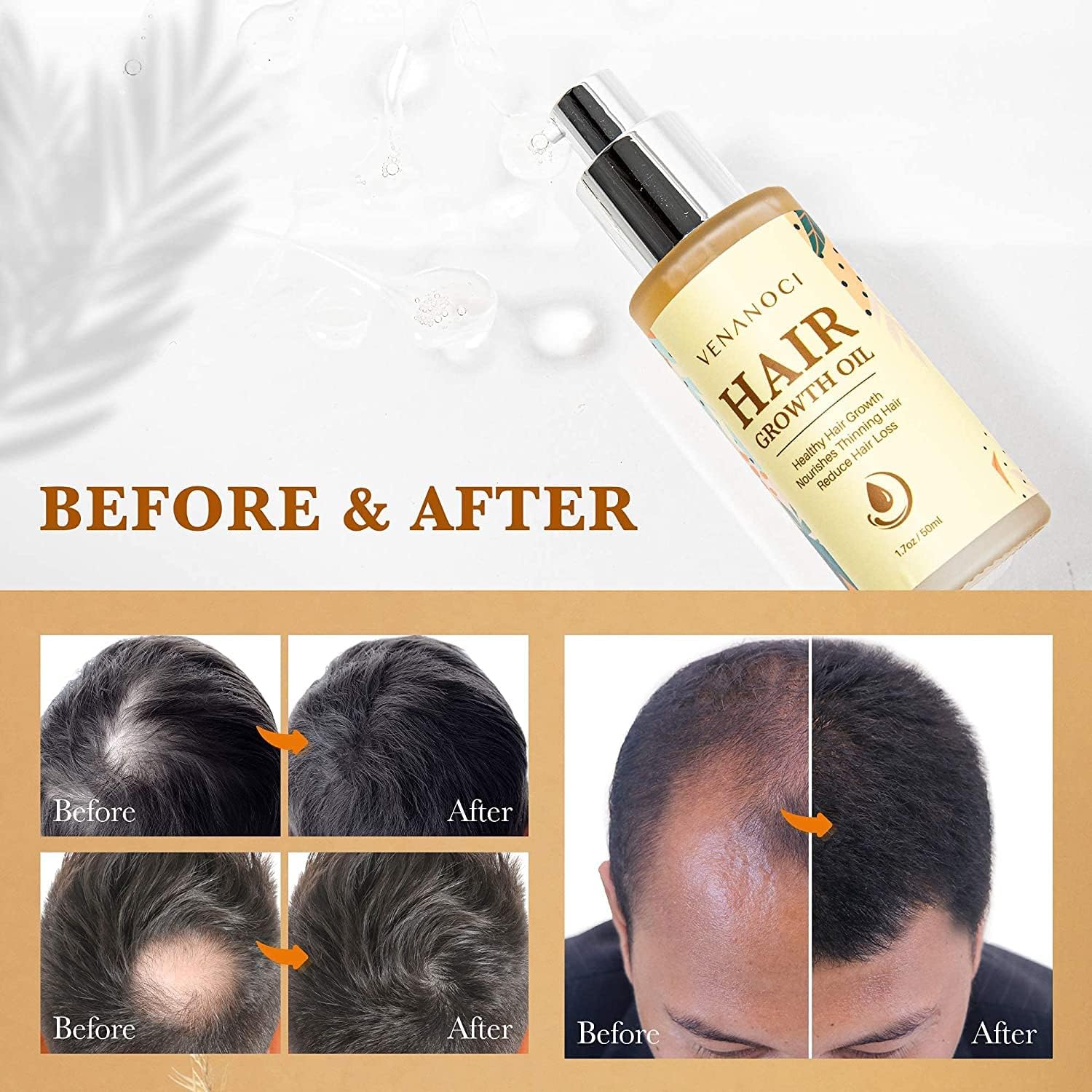 Venanoci scalp massage action image highlighting daily routine for healthier roots