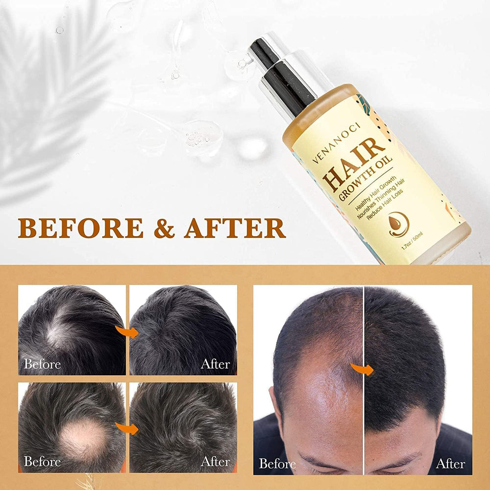 Venanoci scalp massage action image highlighting daily routine for healthier roots