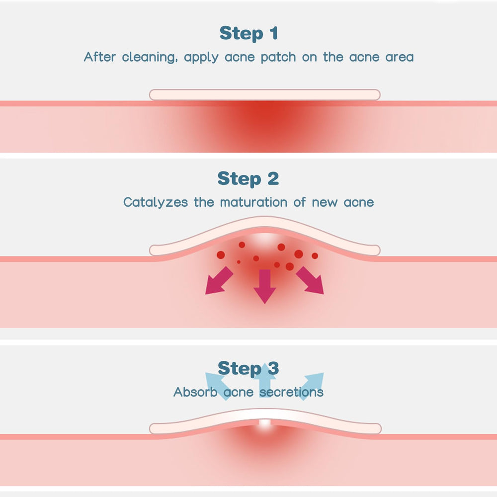 Venrock patches application step demonstrating how to apply on blemish