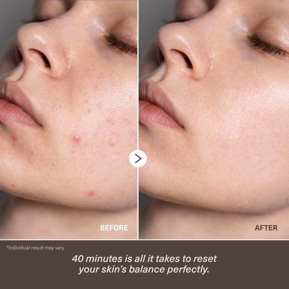 Veyka ceramide-multi-peptide absorption demonstrates deeper hydration and stronger skin barrier.