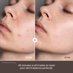 Veyka ceramide-multi-peptide absorption demonstrates deeper hydration and stronger skin barrier.