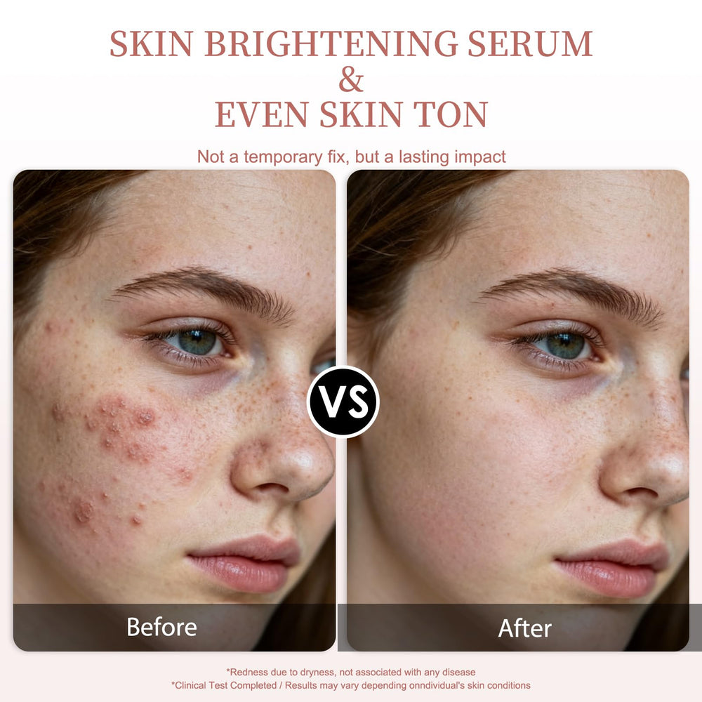 Veyoraus Vitamin C Serum glowing skin after use; dewy finish and even tone.
