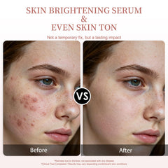 Veyoraus Vitamin C Serum glowing skin after use; dewy finish and even tone.