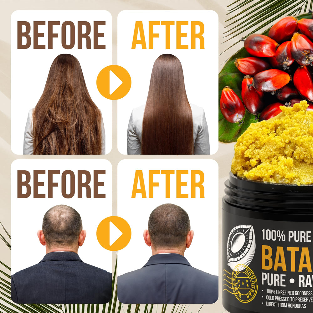 Vie Naturelle Batana oil dropper demonstrates premium moisturizer for dry hair.