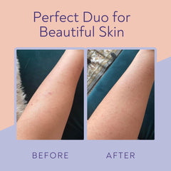 Vigority KP Bump Eraser Scrub jar shows creamy exfoliant for gentle polishing.