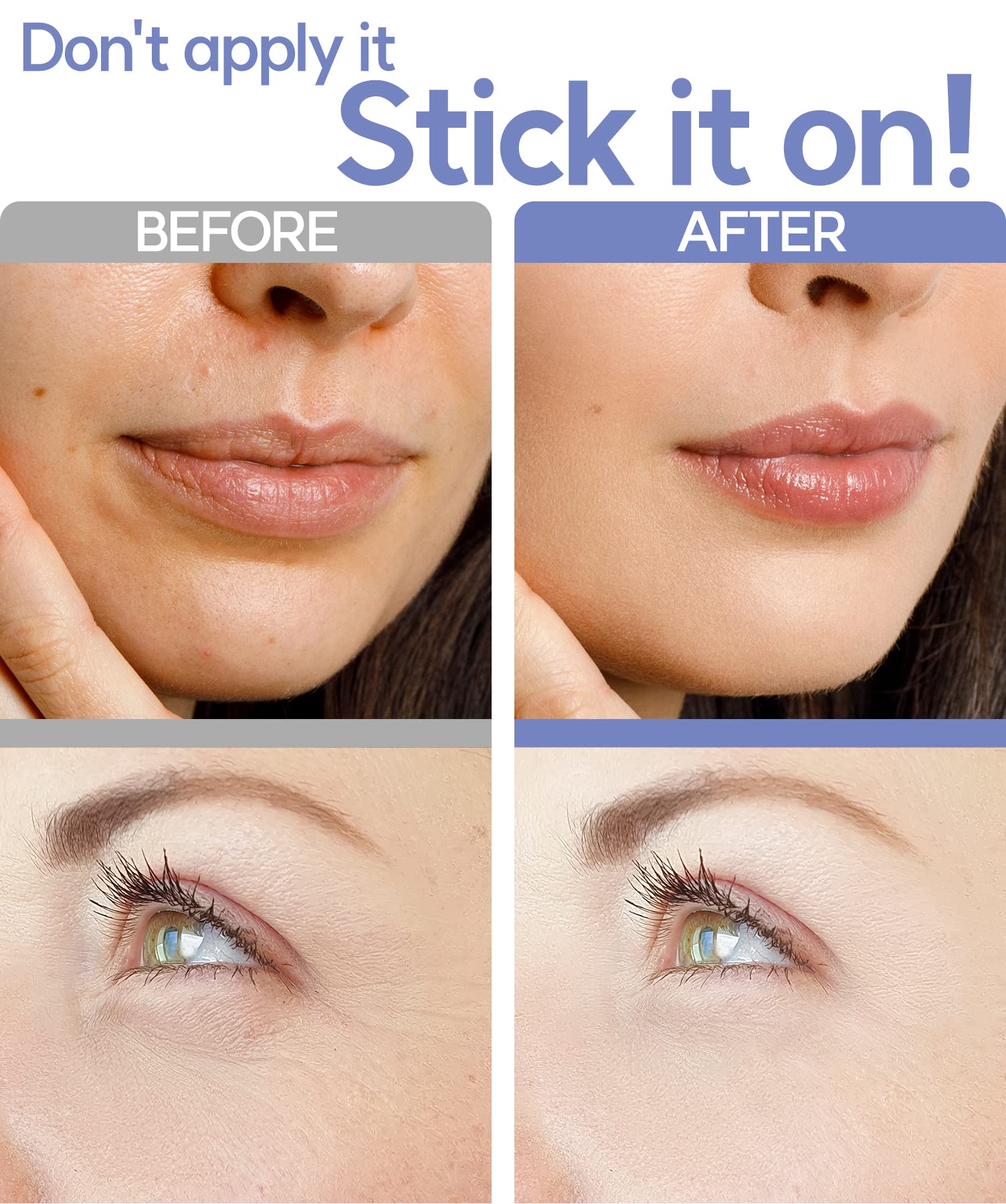 Vilvin microdart patches on forehead for gentle overnight treatment